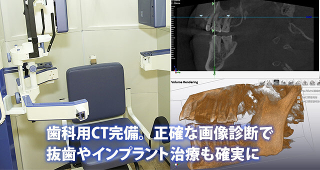 歯科用CT完備。　正確な画像診断で抜歯やインプラント治療も確実に